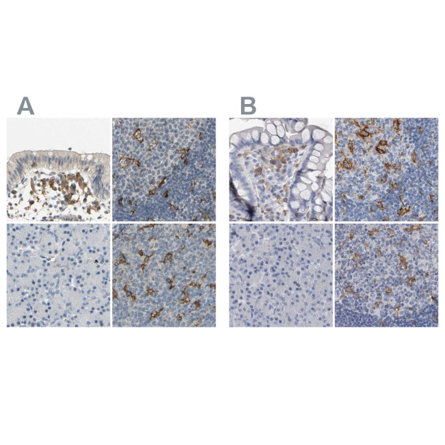 SKAP2 Antibody in Immunohistochemistry (IHC)