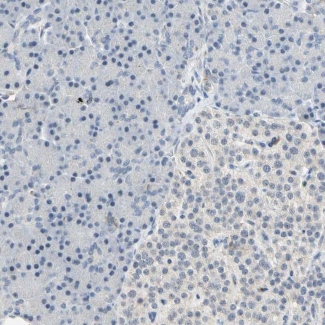 SKAP2 Antibody in Immunohistochemistry (IHC)