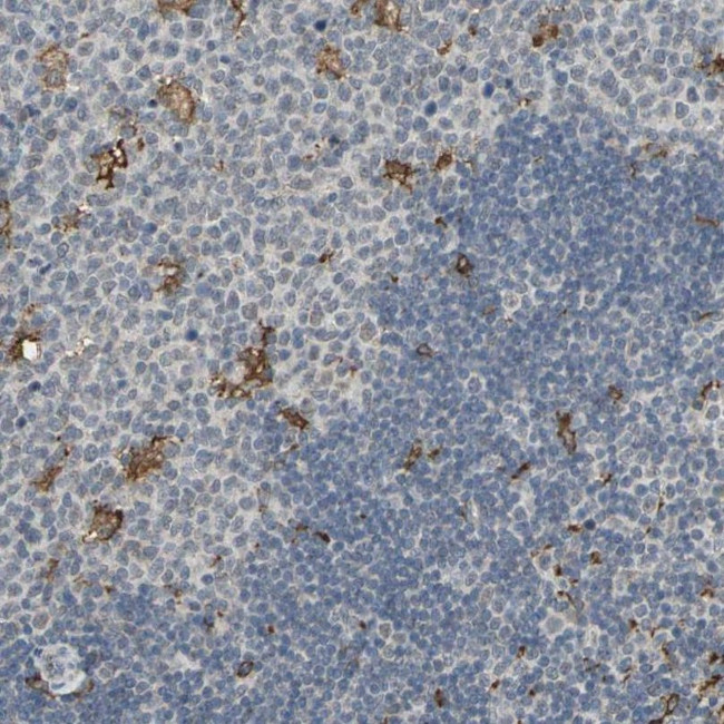 SKAP2 Antibody in Immunohistochemistry (IHC)