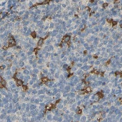 SKAP2 Antibody in Immunohistochemistry (IHC)