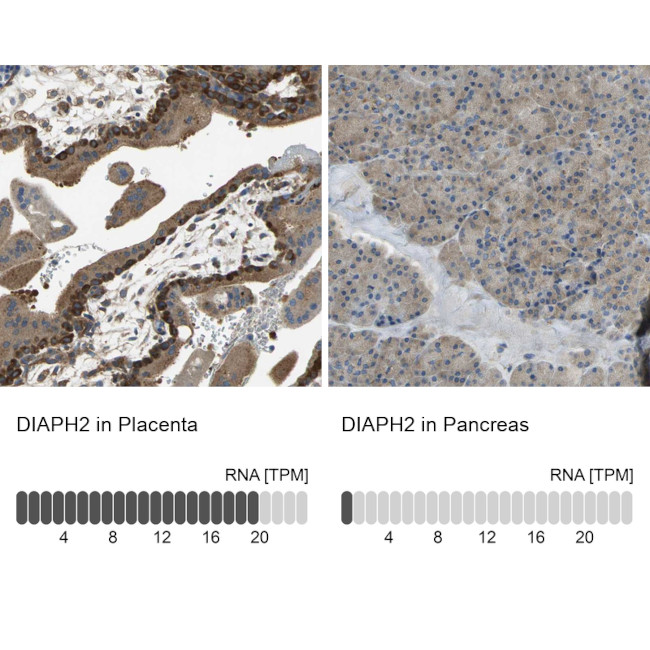 DIAPH2 Antibody in Immunohistochemistry (IHC)