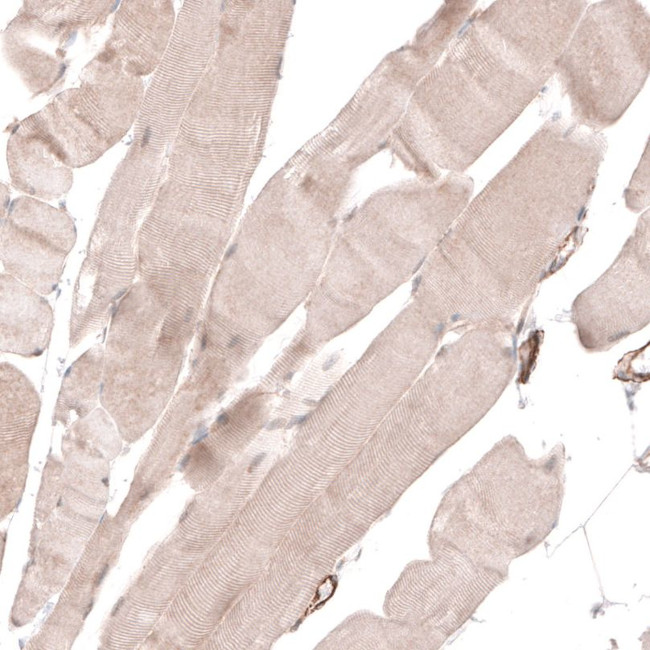 TRIM21 Antibody in Immunohistochemistry (IHC)