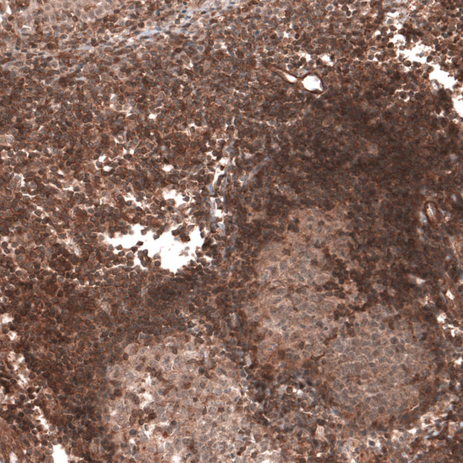 TRIM21 Antibody in Immunohistochemistry (IHC)