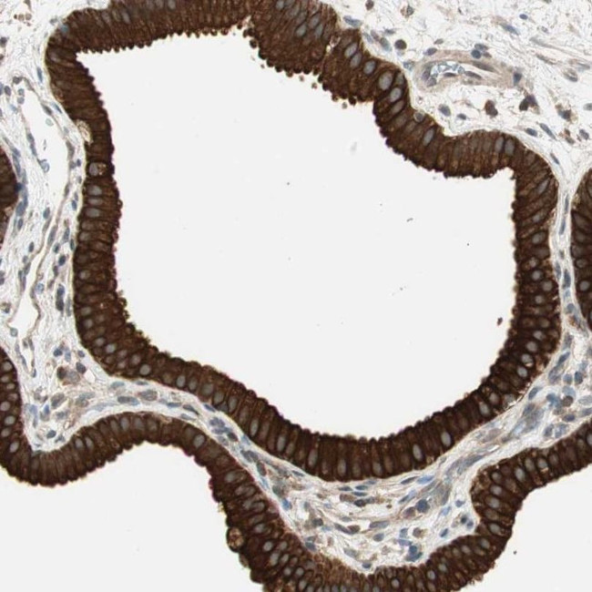 TRIM21 Antibody in Immunohistochemistry (IHC)