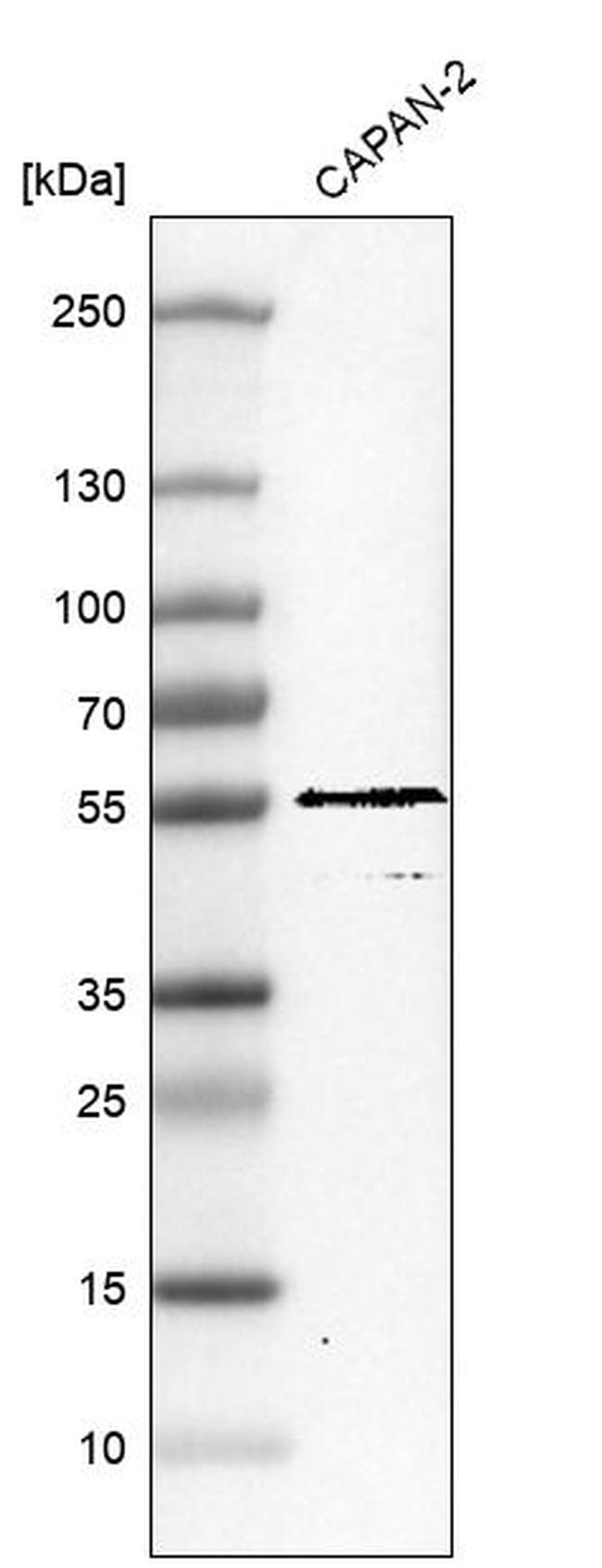 TRIM21 Antibody in Western Blot (WB)