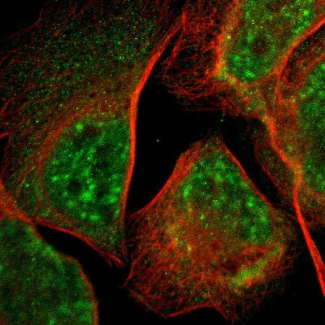 LDOC1L Antibody in Immunocytochemistry (ICC/IF)