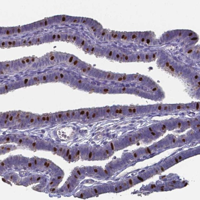 FOXJ1 Antibody in Immunohistochemistry (IHC)