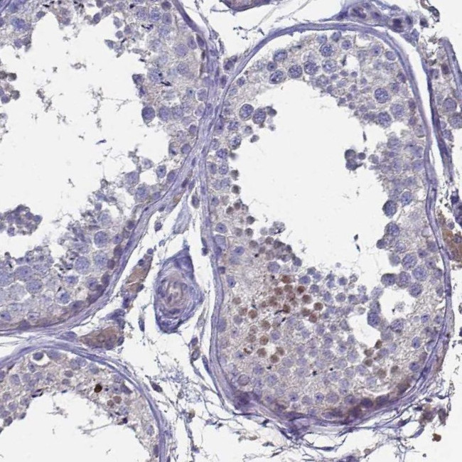 FOXJ1 Antibody in Immunohistochemistry (IHC)