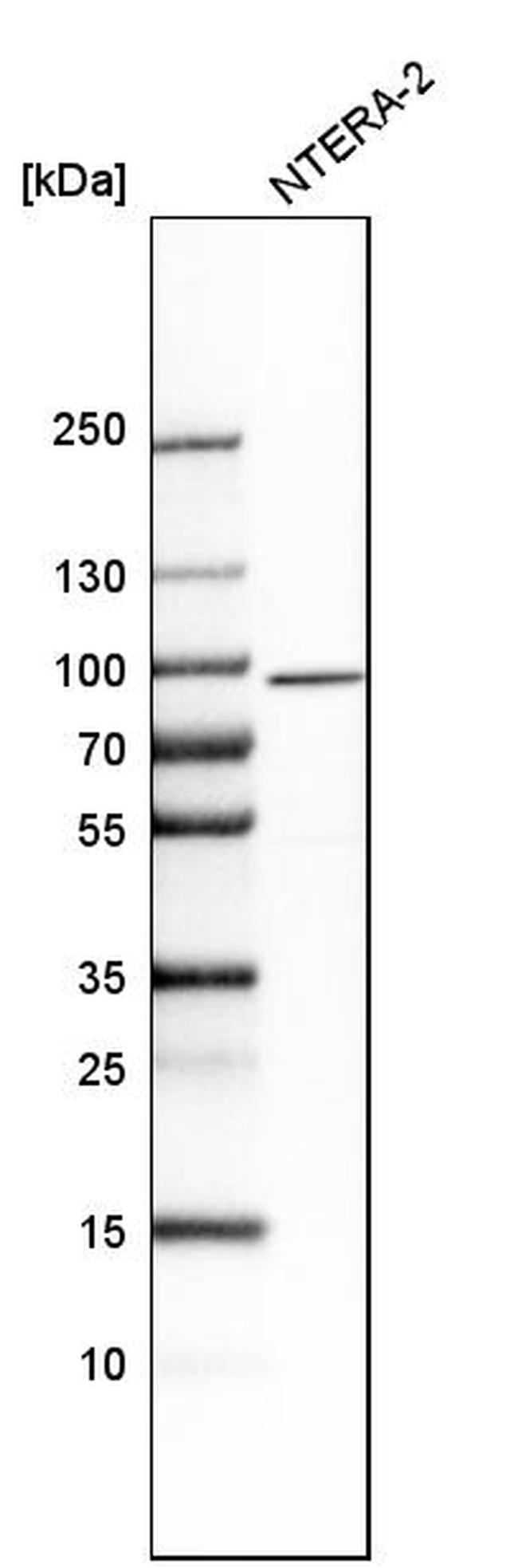 SALF Antibody in Western Blot (WB)