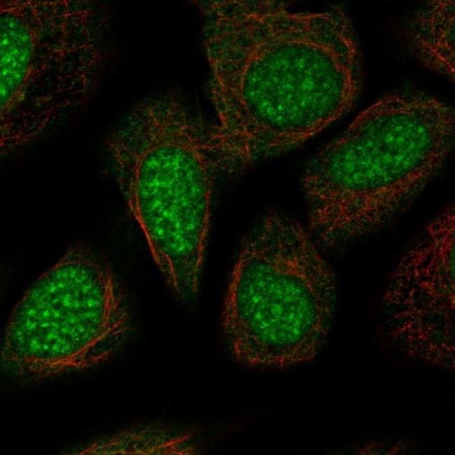 TRIP13 Antibody in Immunocytochemistry (ICC/IF)