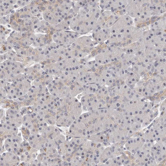 TRIP13 Antibody in Immunohistochemistry (IHC)