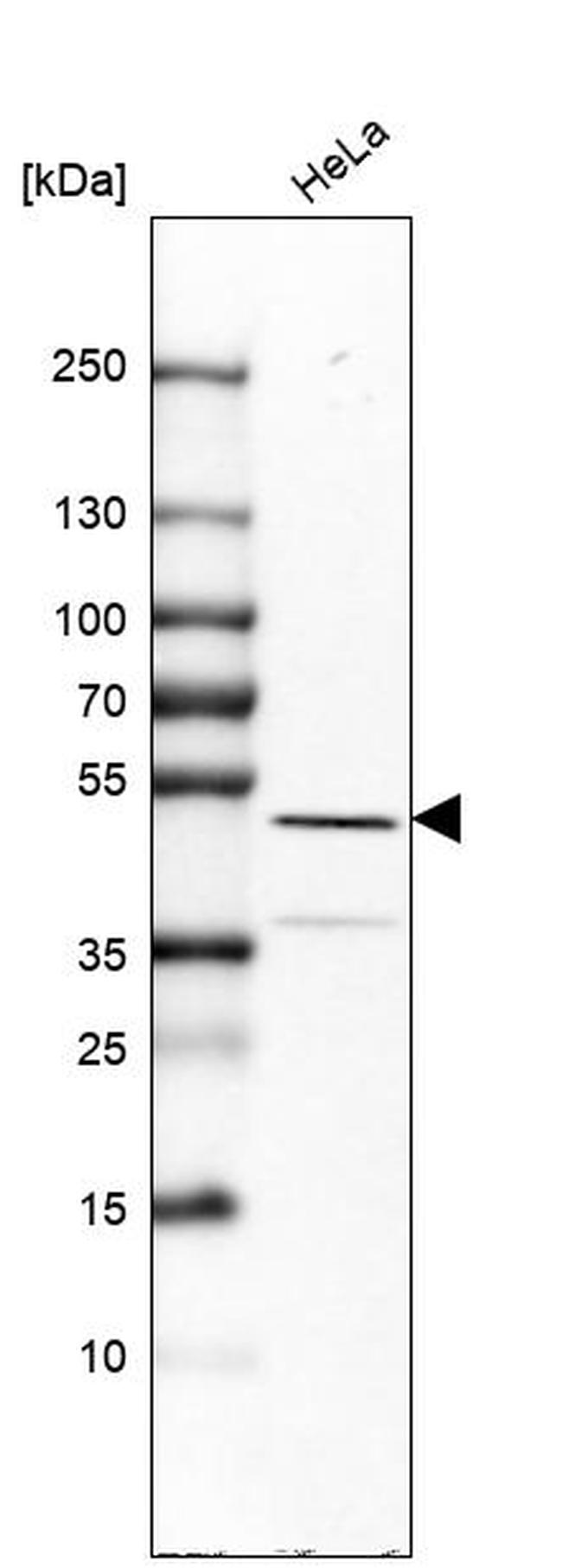 TRIP13 Antibody in Western Blot (WB)