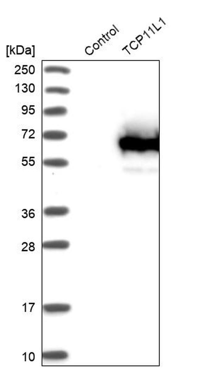 TCP11L1 Antibody in Western Blot (WB)