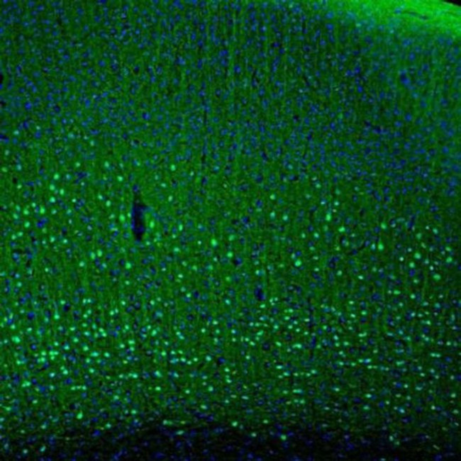 PCP4 Antibody in Immunohistochemistry (IHC)