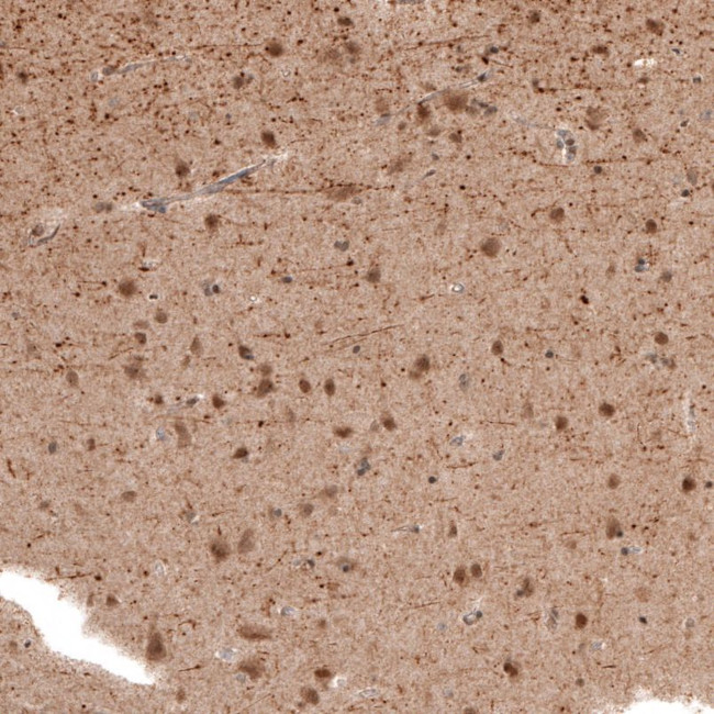 PCP4 Antibody in Immunohistochemistry (IHC)