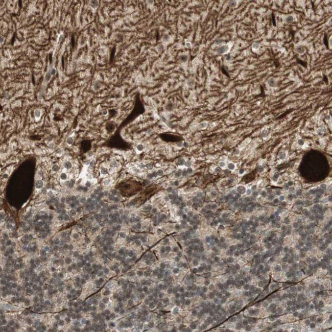 PCP4 Antibody in Immunohistochemistry (IHC)