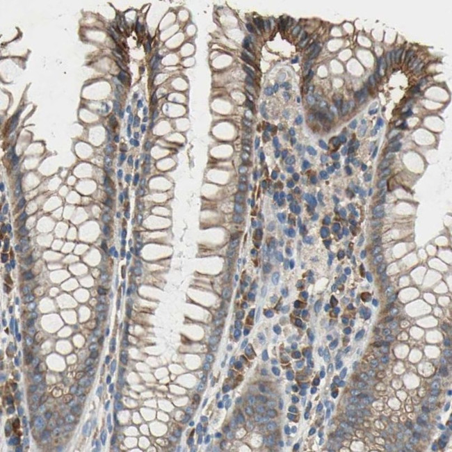 HEPH Antibody in Immunohistochemistry (IHC)