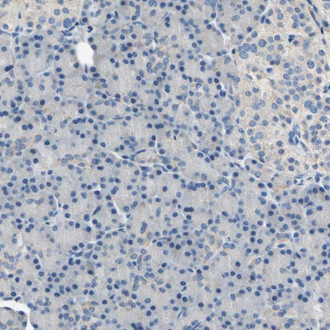 RASD2 Antibody in Immunohistochemistry (IHC)