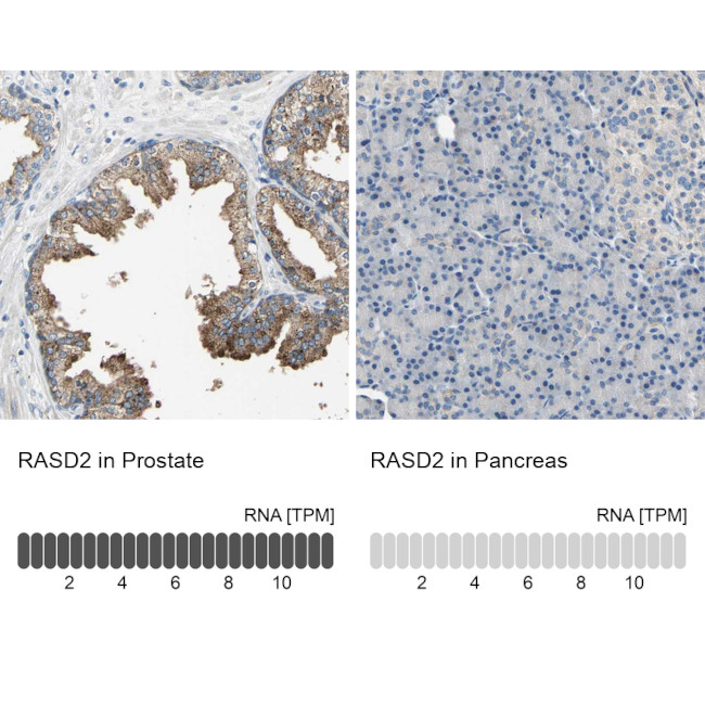RASD2 Antibody
