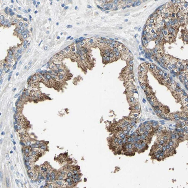 RASD2 Antibody in Immunohistochemistry (IHC)