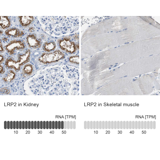 LRP2 Antibody in Immunohistochemistry (IHC)