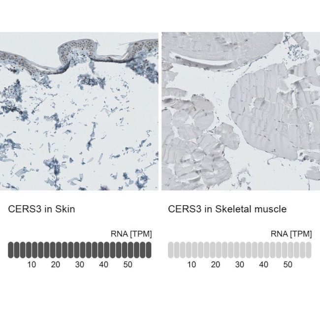 Lass3 Antibody in Immunohistochemistry (IHC)