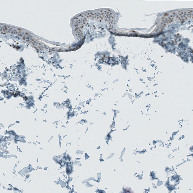 Lass3 Antibody in Immunohistochemistry (IHC)