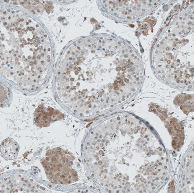 Lass3 Antibody in Immunohistochemistry (IHC)