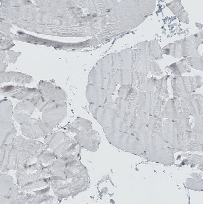 Lass3 Antibody in Immunohistochemistry (IHC)