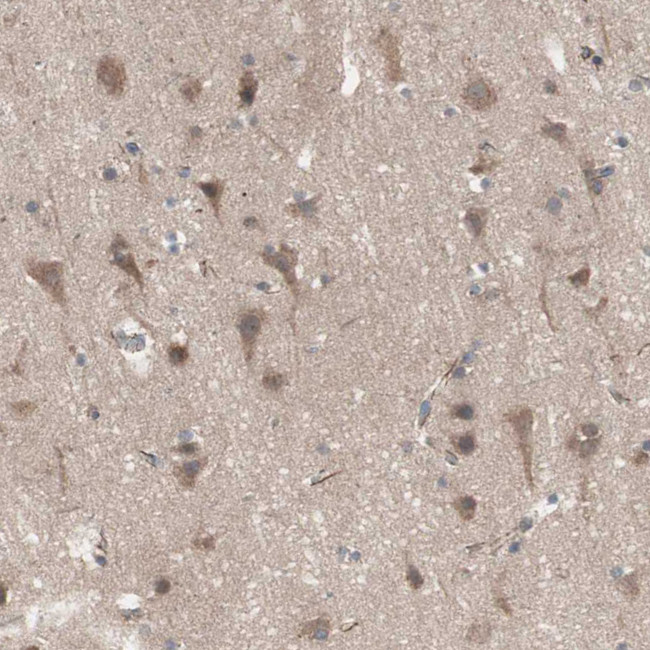 HMBS Antibody in Immunohistochemistry (IHC)