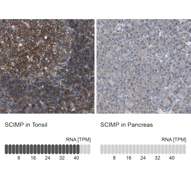 SCIMP Antibody in Immunohistochemistry (IHC)