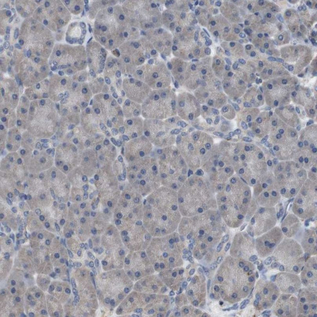 SCIMP Antibody in Immunohistochemistry (IHC)