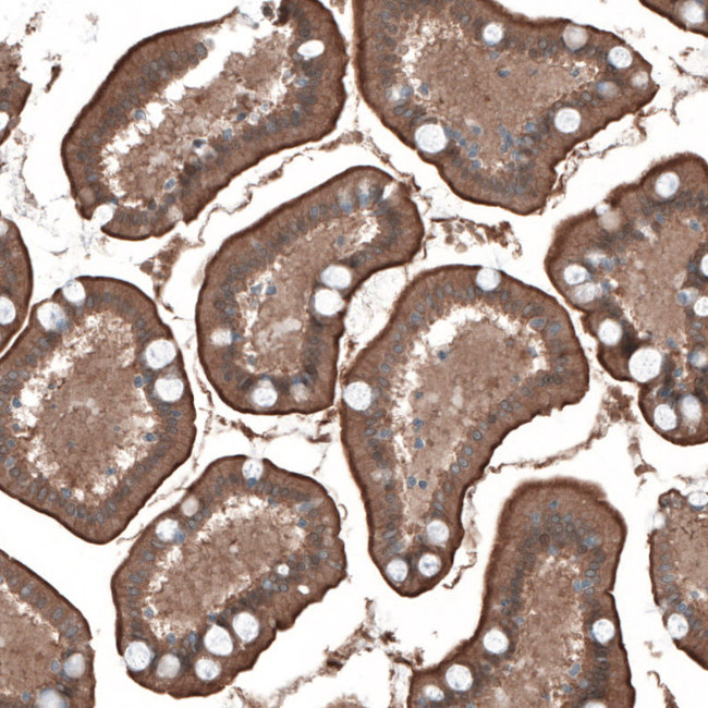 PDZK1 Antibody in Immunohistochemistry (IHC)