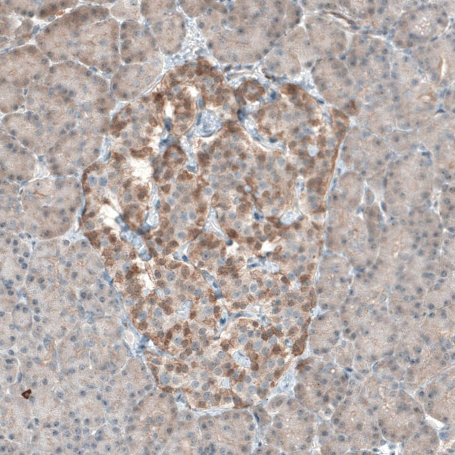 PDZK1 Antibody in Immunohistochemistry (IHC)