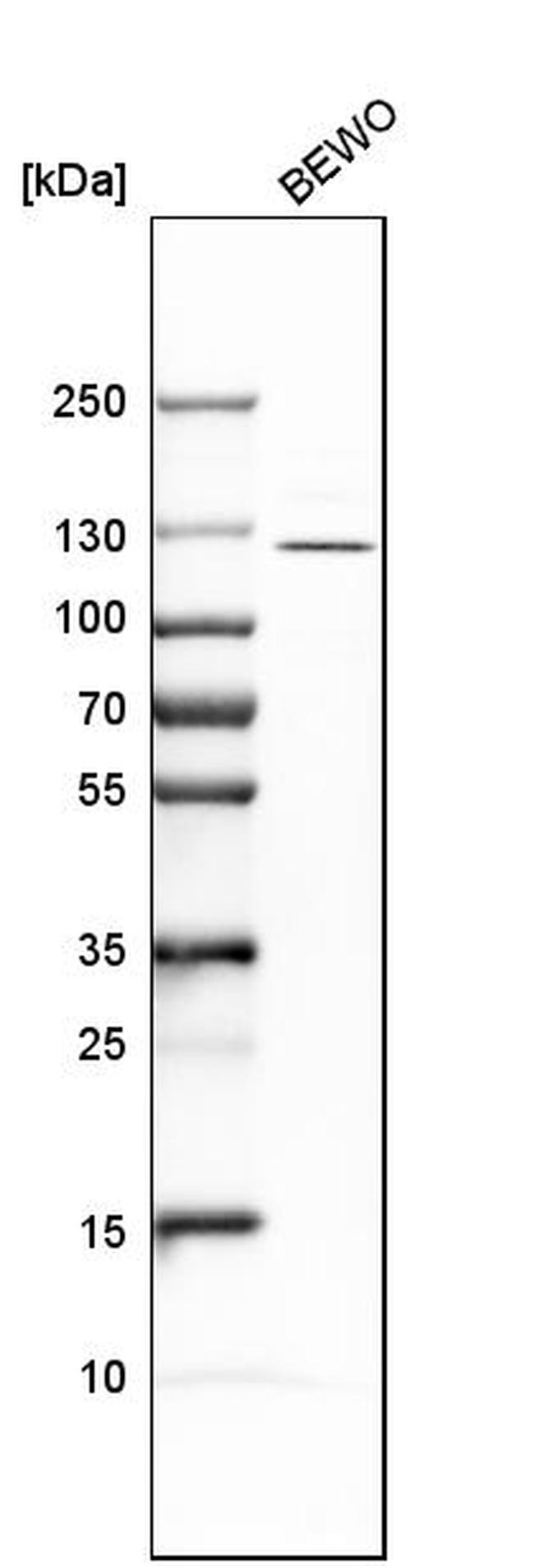 ADAMTSL4 Antibody in Western Blot (WB)