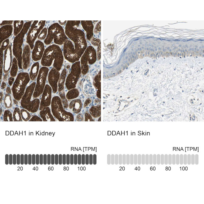 DDAH1 Antibody in Immunohistochemistry (IHC)