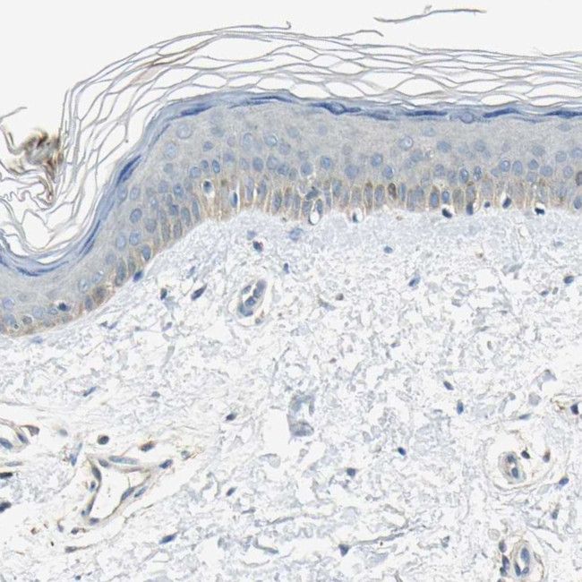 DDAH1 Antibody in Immunohistochemistry (IHC)