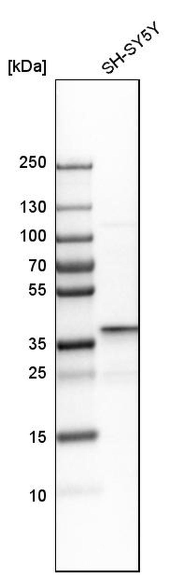 DDAH1 Antibody in Western Blot (WB)