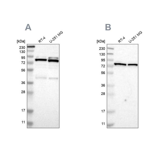 PARN Antibody in Western Blot (WB)