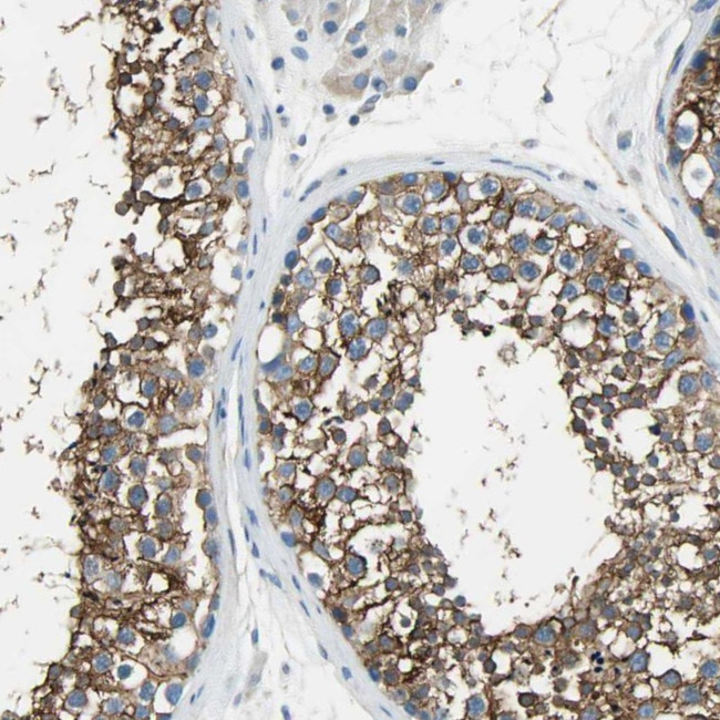 AKAP12 Antibody in Immunohistochemistry (IHC)