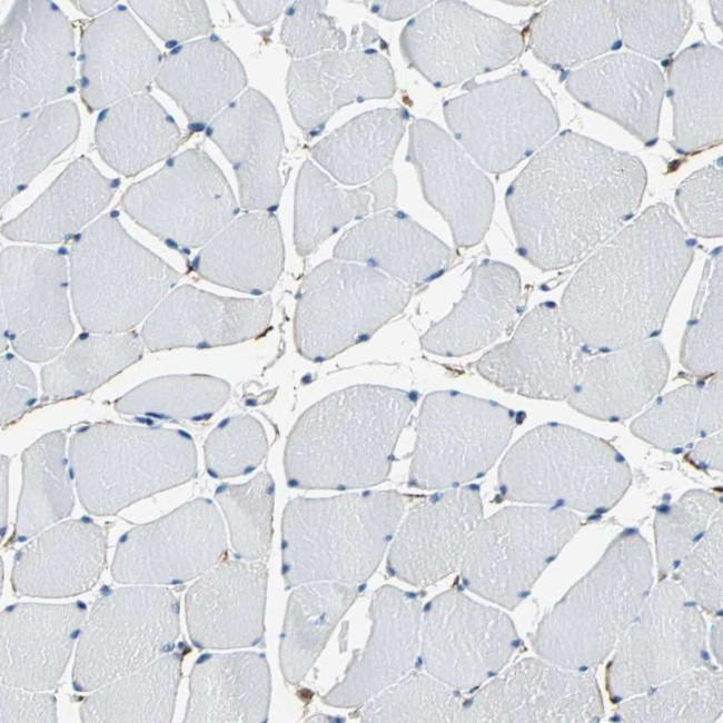 AKAP12 Antibody in Immunohistochemistry (IHC)