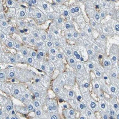 AKAP12 Antibody in Immunohistochemistry (IHC)