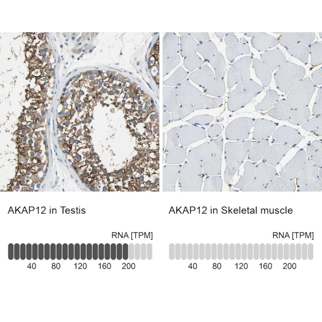 AKAP12 Antibody