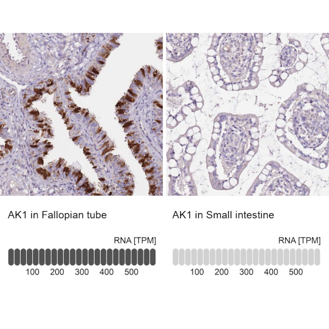 Adenylate Kinase 1 Antibody in Immunohistochemistry (IHC)