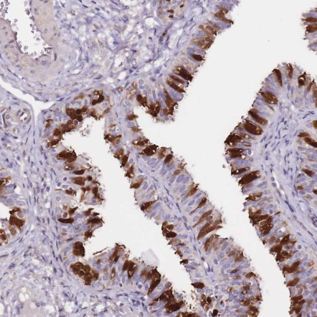 Adenylate Kinase 1 Antibody in Immunohistochemistry (IHC)