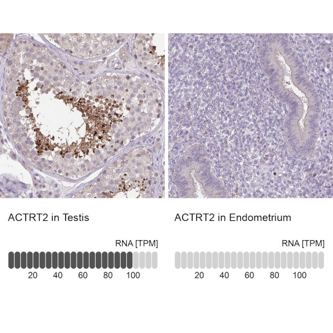 ACTRT2 Antibody in Immunohistochemistry (IHC)