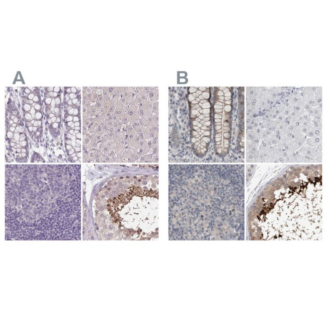 ACTRT2 Antibody in Immunohistochemistry (IHC)