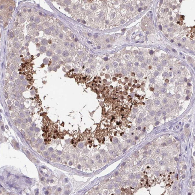 ACTRT2 Antibody in Immunohistochemistry (IHC)