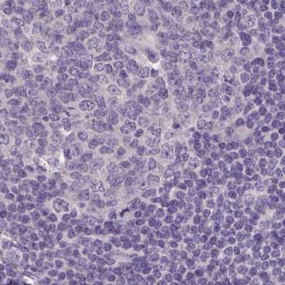 ACTRT2 Antibody in Immunohistochemistry (IHC)