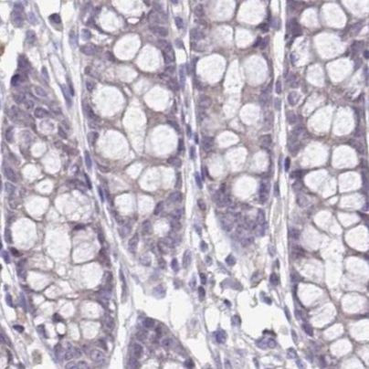 ACTRT2 Antibody in Immunohistochemistry (IHC)